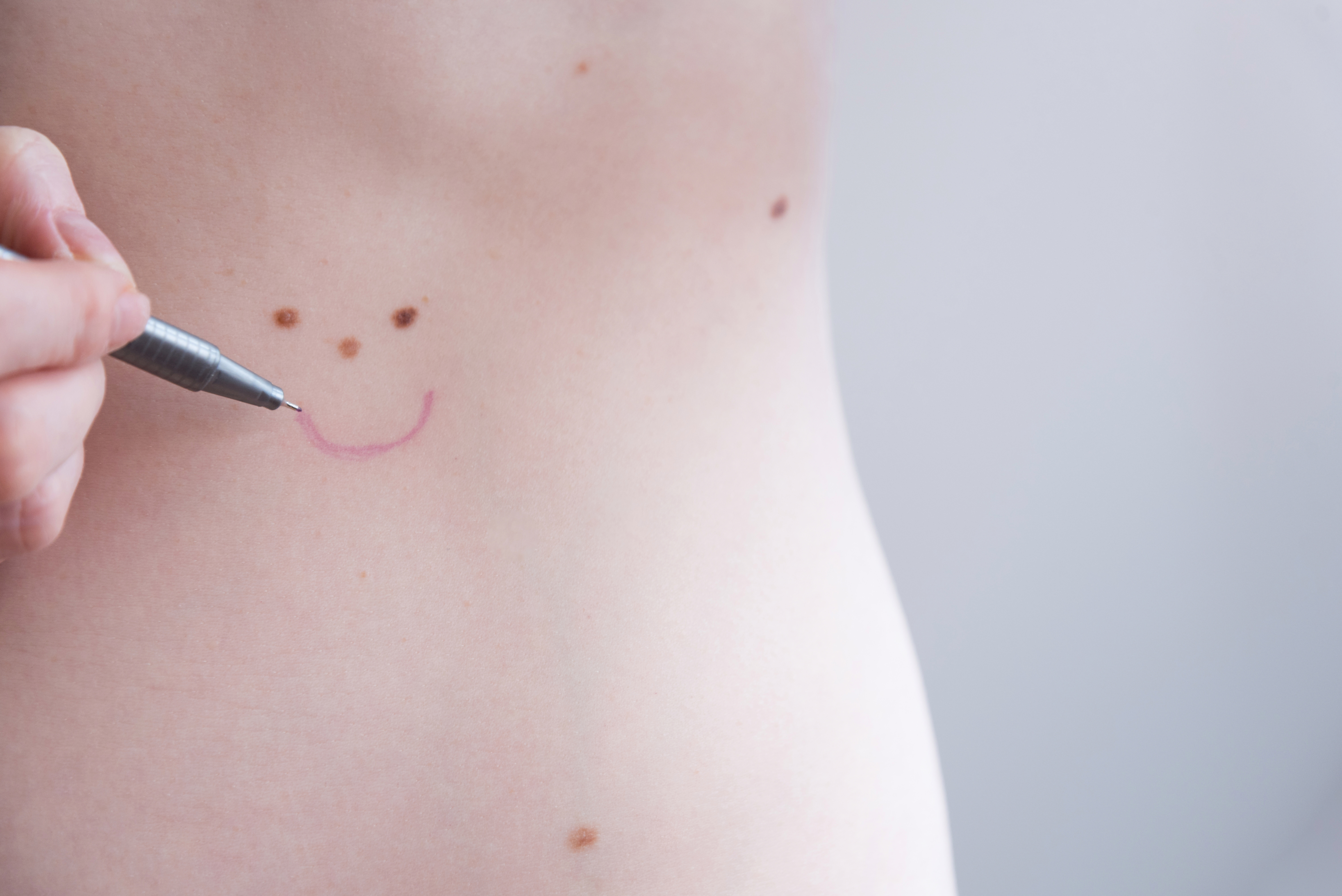 A picture of moles