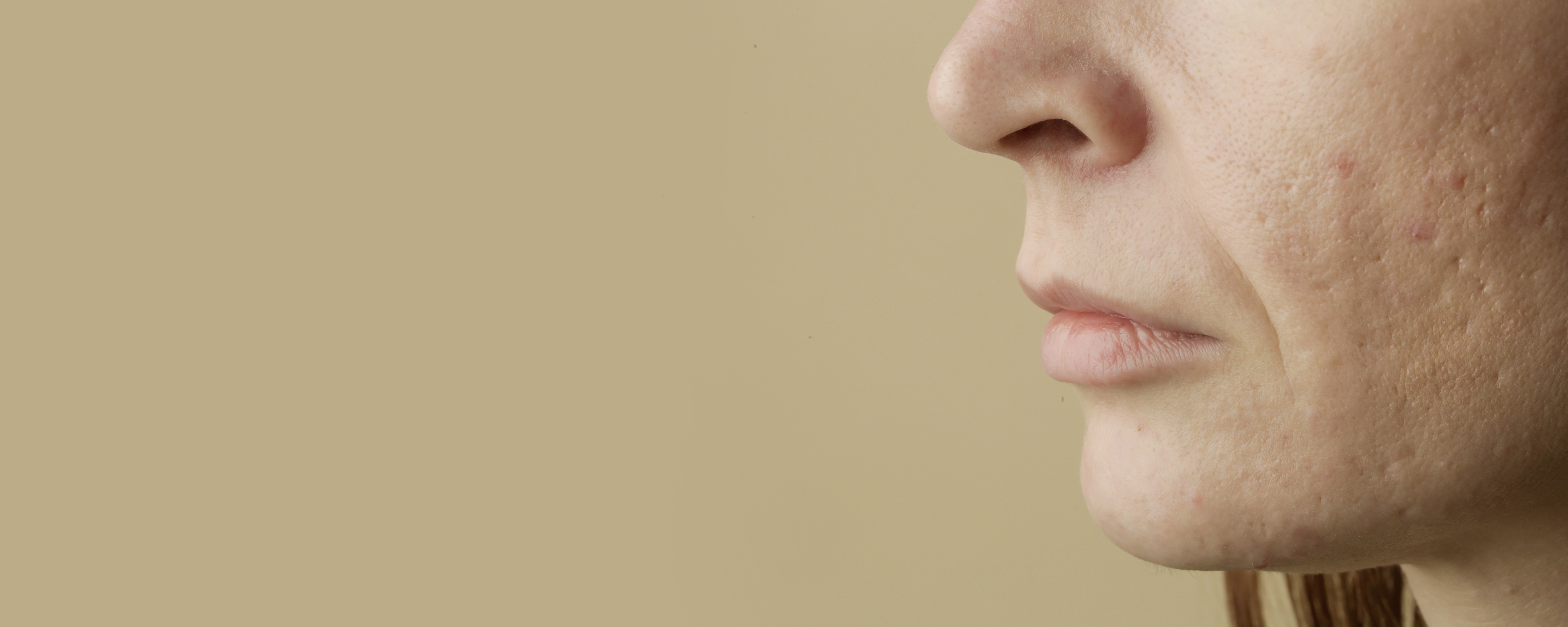 A face with scars