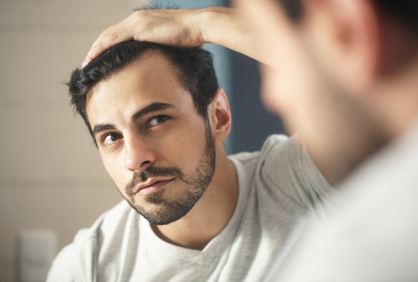 Man with hairloss